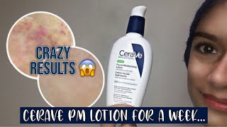 I Used Cerave Skincare  Facial Moisturizing PM Lotion Review  Lucidly Selfcare [upl. by Eiliah]