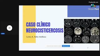 Neurocisticercosis  Clase 0 Caso clínico [upl. by Raf]