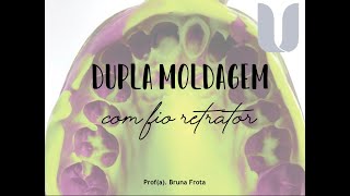 MOLDAGEM COM FIO RETRATOR [upl. by Yrojram]