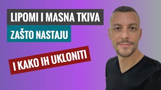 Šta su lipomi i kako se uklanjaju [upl. by Ayiram]