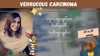 verrucous carcinoma I oral path [upl. by Napoleon]