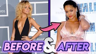 Rihanna  Before amp After Transformation  Thicc amp Beautiful [upl. by Syah]