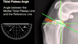 Measuring Tibial Plateau Angle [upl. by Zenda]