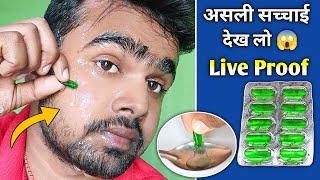 Evion 400 Capsule के असली सच्चाई  Evion 400 For Skin  Vitamin E Capsule For Skin  Evion 400 [upl. by Drescher275]