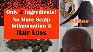 Annatto and Pimento Seed Oil For Baldness amp Fast Hair Growth alopecia hairlosstreatment [upl. by Neicul]