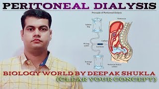 Peritoneal dialysis Continuous ambulatory peritoneal dialysis CAPD [upl. by Annaear495]