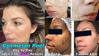 COSMELAN PEEL  Skin Expert SECRETS to CORRECT skin recovery and Best results2021 MUST WATCH [upl. by Dadirac]