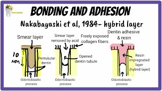 Enamel and Dentin Bonding Made SUPER EASY  Dental Materials [upl. by Yelrehs]