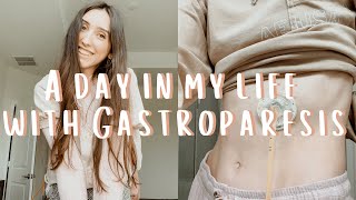 a day in my life with gastroparesis and a GJ feeding tube [upl. by Eelyr]