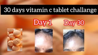 vitamin c tablet 30 days challange in tamil [upl. by Akoek]