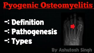 OSTEOMYELITIS Pathology [upl. by Ahsatsan834]