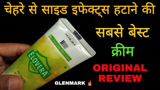 Elovera Original Cream Glenmark Side Effects Removal 🔥 [upl. by Doersten]