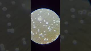 brownian motion in yeast under a microscope [upl. by Wooster]