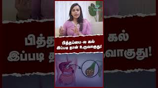 பித்தப்பைல கல் இப்படி தான் உருவாகுது  Gallbladder stone [upl. by Ainala121]