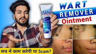 Wart Remover Cream Review  Wart Remover Ointment [upl. by Maurizia297]