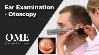 Otoscopy Ear Examination  ENT [upl. by Giff]