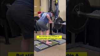 Deadlift Back Injury FULL FIX [upl. by Monroy]