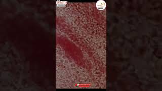 Menstrual blood under microscope periods menstrualcycle menstruation blood menstrualproblems [upl. by Akimrej662]