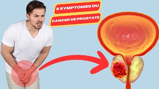 5 symptomes du cancer de la prostate  dépistage cancer prostate  cancer de la prostate symptomes [upl. by Tilly]