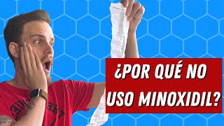 ¿Por qué no uso Minoxidil oral o tópico para la caída de mi pelo [upl. by Ainadi]