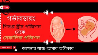 How to Safely Turn a Breech Baby Bangla [upl. by Llyrpa]