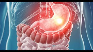 MRCP PART ONEPASSMEDICINE 2021 GASTROENTROLOGY 1 [upl. by Garap]