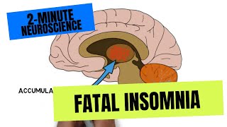 2Minute Neuroscience Fatal Insomnia [upl. by Ralyat]