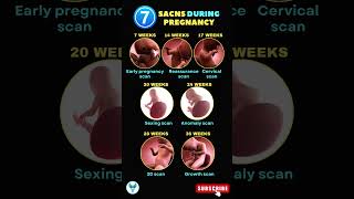 Types of Scans during Pregnancy  Anomaly Scan  3D scan in Pregnancy shortsvideo pregnancy scans [upl. by Kalindi736]