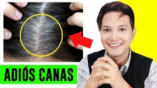 COMO ELIMINAR LAS CANAS NATURALMENTE CON REMEDIOS CASEROS  AndyZarturno [upl. by Neyrb190]