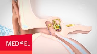 Veja Como Curar Uma Infecção no Ouvido Naturalmente [upl. by Kahn425]