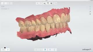 3Shape TRIOS 3 3D ve Renk Kalibrasyonu  3D and Color Calibration [upl. by Gasperoni644]