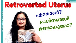 Retroverted Uterus  റിട്രോവെർട്ടഡ് യൂട്ടറസ്  പ്രശ്നങ്ങൾ ഉണ്ടാകുമോ  Dr Sita  Malayalam [upl. by Yrhcaz]