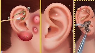 Ear Animation Clean games 🎮 [upl. by Yraeg574]