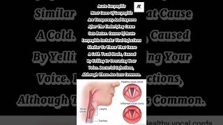 Acute Laryngitis  viral shorts trending medical draleenatariq [upl. by Kobylak926]