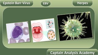 Epstein Barr VirusEBV ابشتين فيرس Herpes من اهم الفييروسات المسببه للاورام والسرطانات [upl. by Gwendolin852]