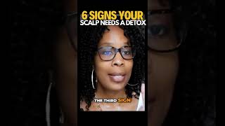 6 Signs You Need a Scalp Detox for Hair Growth  blackhaircare haircare naturalhair [upl. by Finlay]