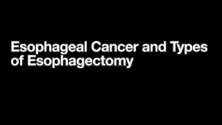 The Three Types of Esophagectomy [upl. by Eenimod]