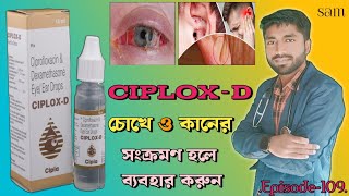 Ciplox D Eye Ear Drops❓Ciprofloxacin Dexamethasone Eye Ear Drops❓Ciplox D Drops [upl. by Delanty49]