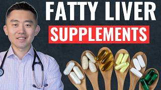 Best Supplements to Reverse Fatty Liver ScienceBacked [upl. by Nelon]