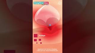 🔴 BiseptineCica®  Cicatrisation plus rapide des plaies superficielles [upl. by Pauletta]