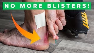 How to never get blisters again  Top 5 blister hacks [upl. by Ulrikaumeko]