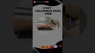 😱X ray calcaneus positioningshortsvideo ytshorts radiology xray radiologyeducation [upl. by Chud]