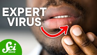 Why Herpes is Different From Other Viruses [upl. by Nael]