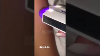 Depilador a laser profissional DepiHair [upl. by Sewell8]