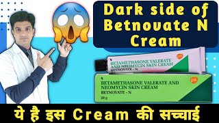 यह है इस क्रीम की सच्चाई  Betnovate n cream awearness  Betnovate n cream [upl. by Elbys]