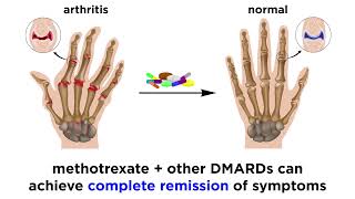 Methotrexate Rheumatoid Arthritis Drug [upl. by Nileak634]