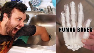 What Happens if You Put Your Hand in a Garbage Disposal [upl. by Nirhtak]