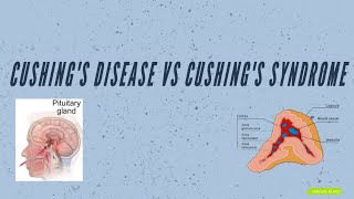 Cushing’s DISEASE vs Cushing’s SYNDROME [upl. by Lorrac351]