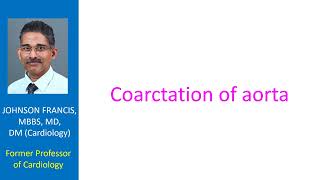 Coarctation of aorta [upl. by Sedruol]