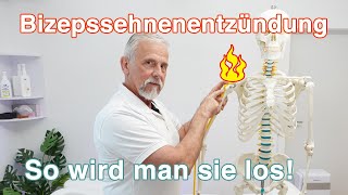 Bizepssehnenentzündung ⚡ So wird man sie los  Übungen und Tipps [upl. by Nally]